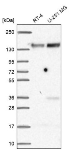 FAM120A Antibody, Novus Biologicals 0.1mL; Unlabeled:Antibodies, Polyclonal